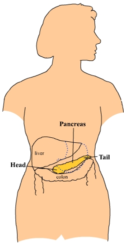 pan